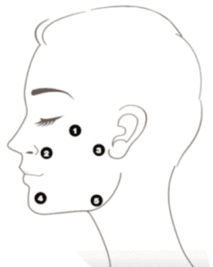 BAP-Injektionstechnik