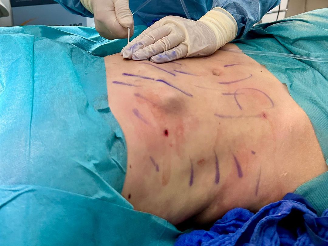 Eigenfettkomposition & Transfer